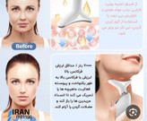 دستگاه جوانسازی پوست صورت